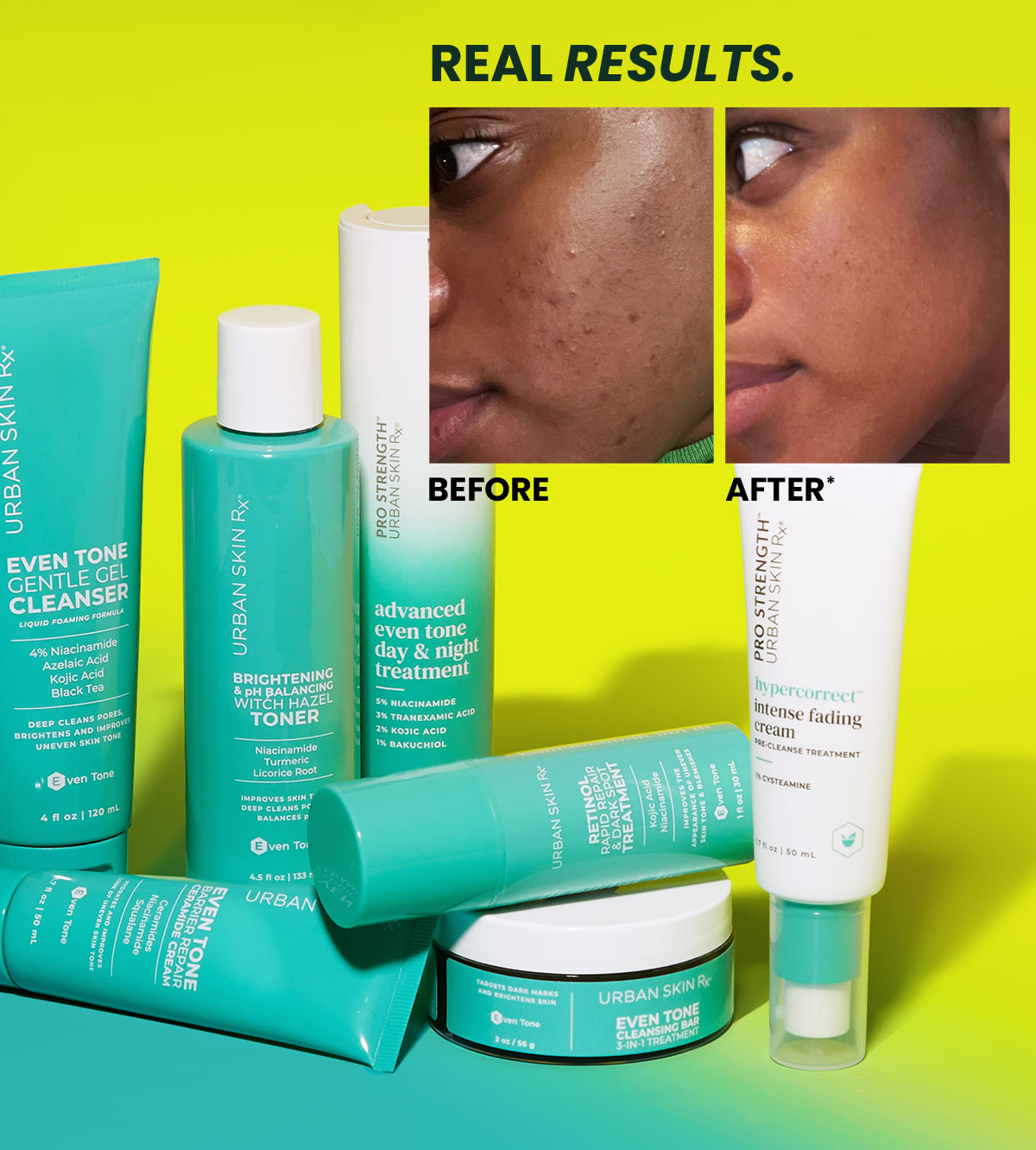 New year, new even tone glow Urban Skin Rx